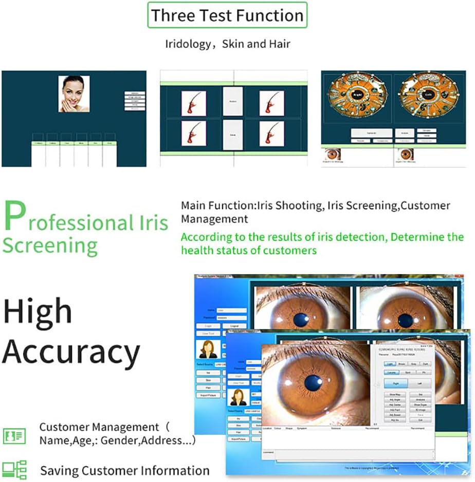 12 MP High Resolution CCD USB Iriscope Diagnostic Eye Camera with 12MP HD 30x Iris Lens and Driver-Free Analysis Software (English Version)