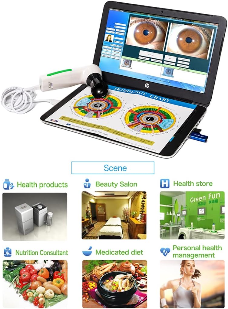 12 MP High Resolution CCD USB Iriscope Diagnostic Eye Camera with 12MP HD 30x Iris Lens and Driver-Free Analysis Software (English Version)