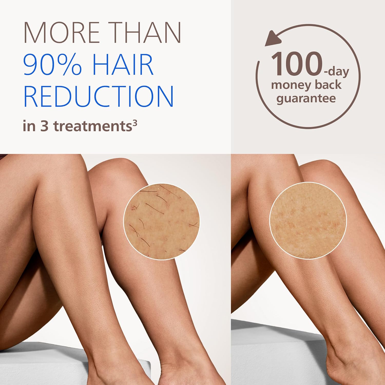Philips Lumea IPL — Salon-Like Laser Hair Removal for Women, Permanent Hair Reduction Device At Home for Face & Body — Safe & Painless for Face, Bikini, Body, 5 Settings & Skin Sensors, BRI984/03